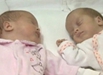 双胞胎女婴出生日期隔2月