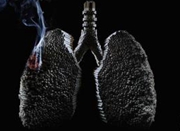 新一代靶向药物在中国获批 肺癌患者迎来新希望